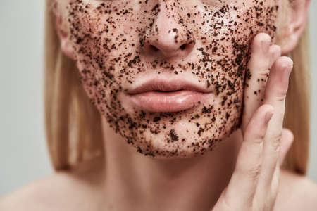 The Ultimate Guide to Understanding and Treating Acne in the U.S.