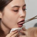 Top 15 Dermatologist-Approved Acne Treatments That Actually Work