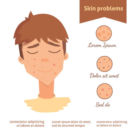 The Role of Melanin in Skin Discoloration