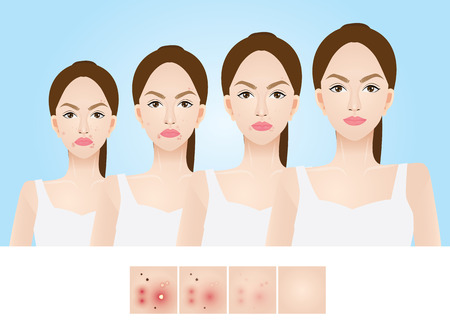 Incorporating Hormone-Friendly Skincare Ingredients