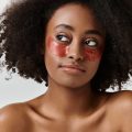 Lifestyle Factors That May Be Worsening Your Hyperpigmentation