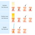 From Botox to Fillers: Navigating Cosmetic Procedures After 40