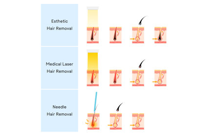 From Botox to Fillers: Navigating Cosmetic Procedures After 40