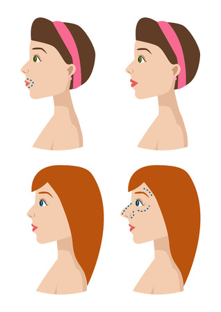 How to Prevent Wrinkles Before They Start: Proactive Anti-Aging Tips